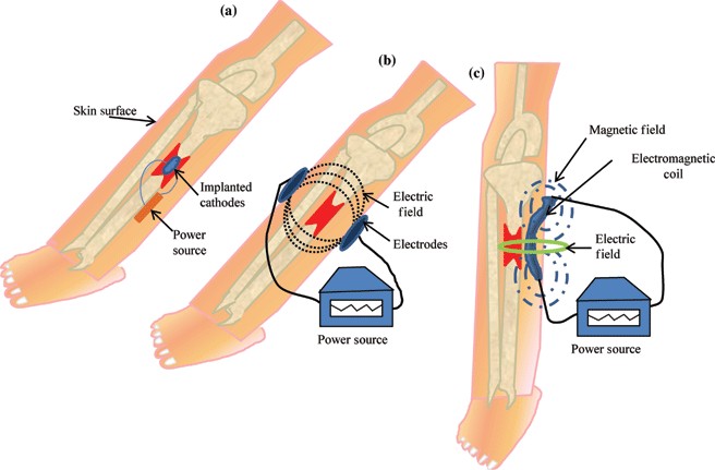 eplasty11e034_fig1